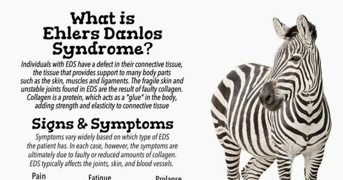 Ehlers-danlos and elevated liver enzymes