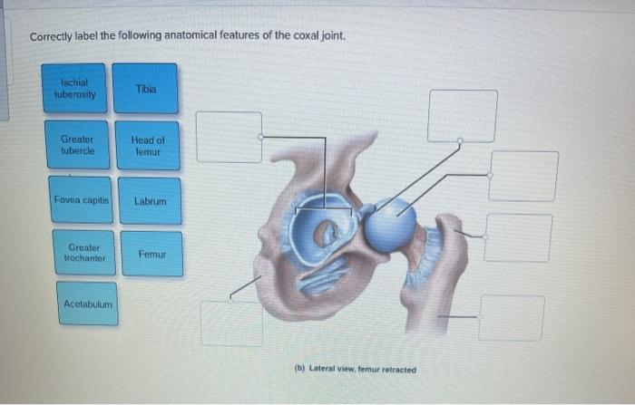 Correctly label the following anatomical features of the coxal joint