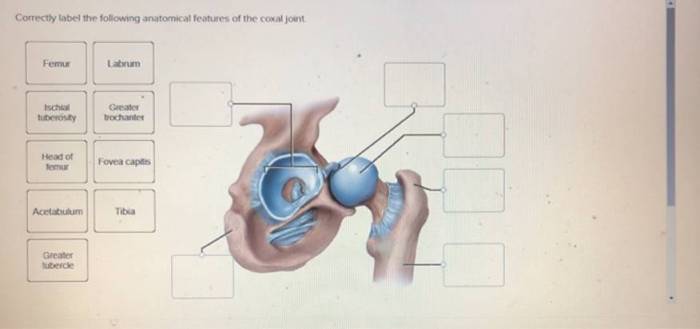 Correctly label the following anatomical features of the coxal joint